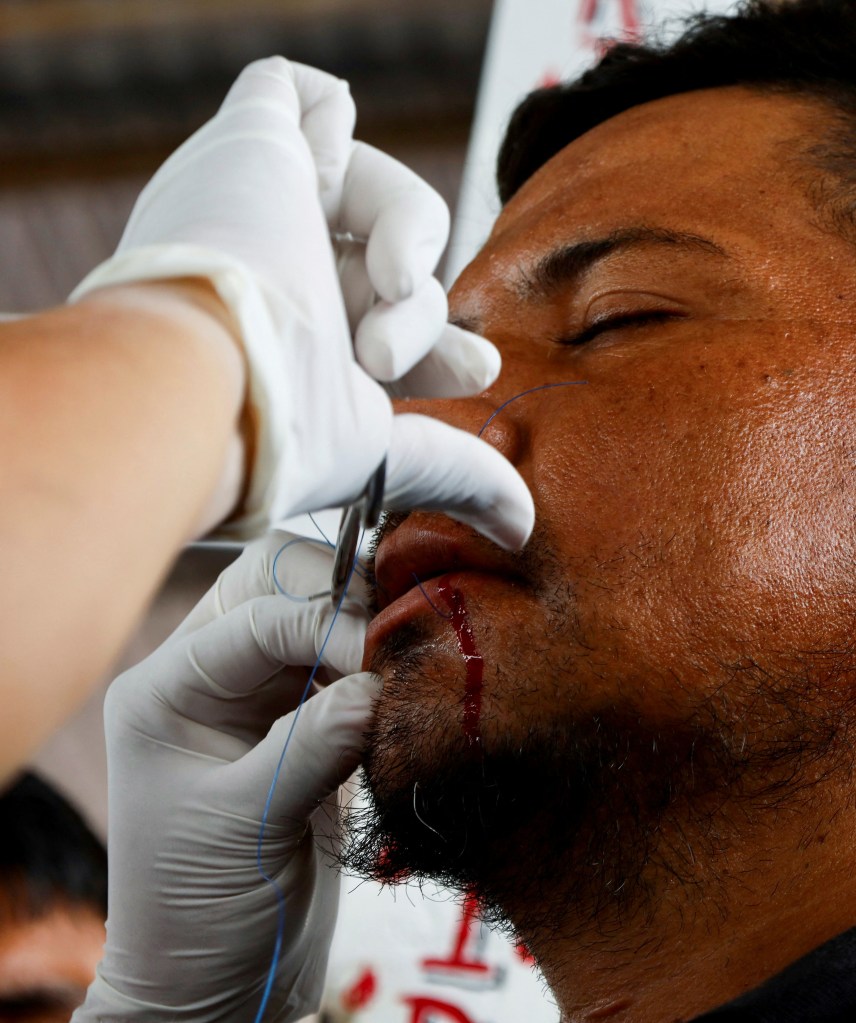 SENSITIVE MATERIAL. THIS IMAGE MAY OFFEND OR DISTURB    A migrant sews his mouth shut at a protest demanding free transit through Mexico in an attempt to reach the U.S. border, in Huixtla, Mexico November 2, 2023. REUTERS/Jose Torres